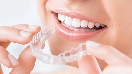 透明なマウスピースを装着しようとしている様子