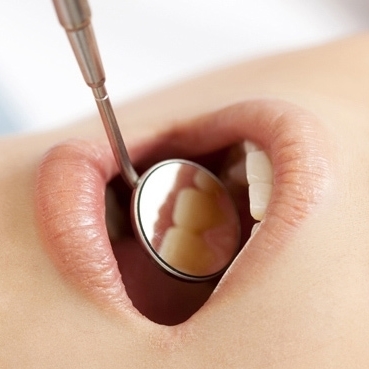 経過観察で口を開けて診察を受ける様子