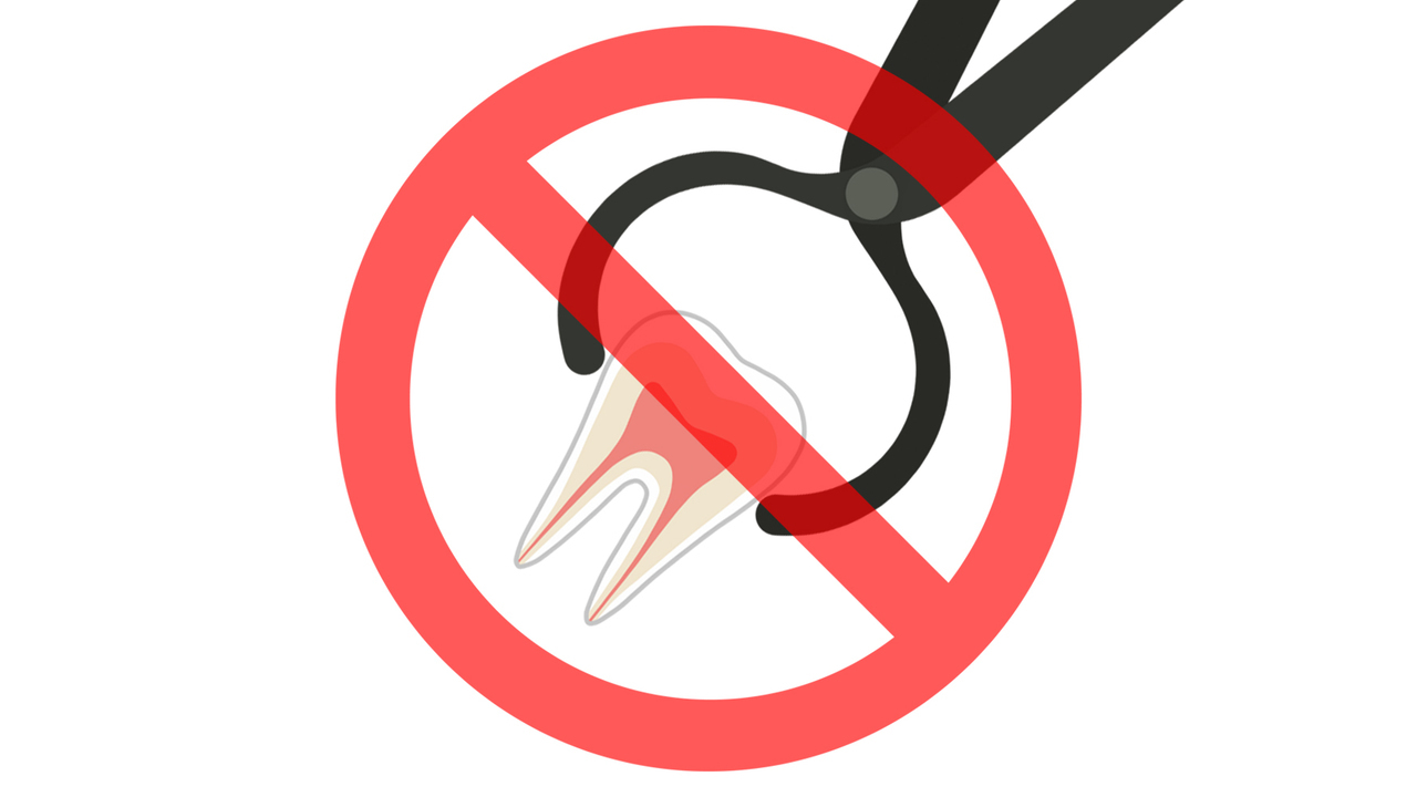 非抜歯矯正について詳しく解説するページへのリンク